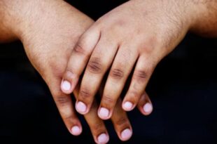 3 home remedies to get rid of dark knuckles