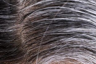 How to reverse premature grey hair naturally