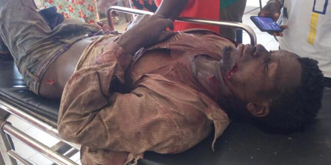 Two farmers brutally attacked by suspected Fulani herdsmen in Taraba after they attempted to stop cows from eating their crops