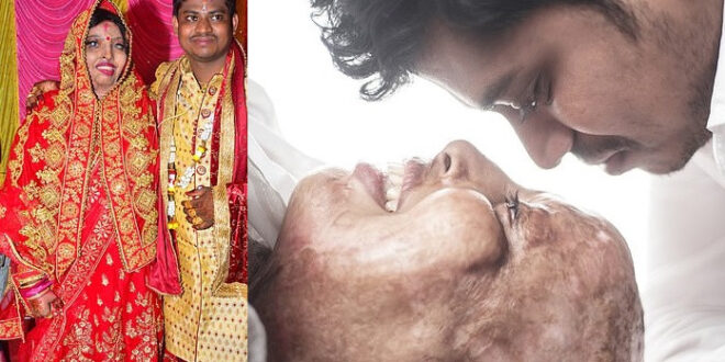 Woman, 28, who survived acid attack after rejecting a marriage proposal at 15, marries a man she met while in hospital (Photos)