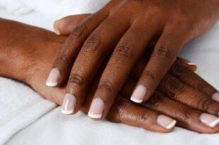 Dark Knuckles: 1 fast, natural way to lighten discoloured areas on the body