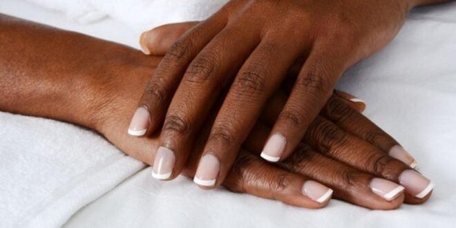 Dark Knuckles: 1 fast, natural way to lighten discoloured areas on the body