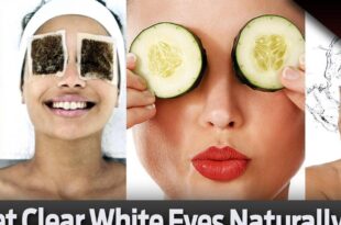 How to get clear white eyes naturally