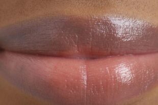 If you have dark lips try these 2 natural remedies