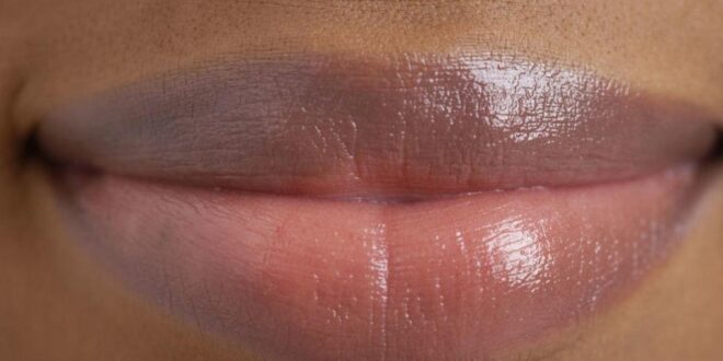 If you have dark lips try these 2 natural remedies