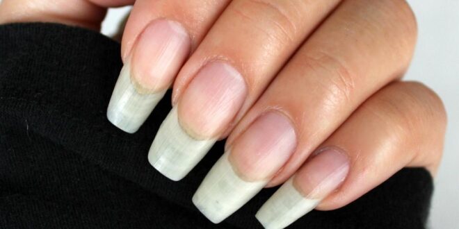 5 foods to add to your daily diet for stronger nails