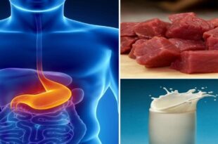 5 foods to avoid if you have stomach ulcer