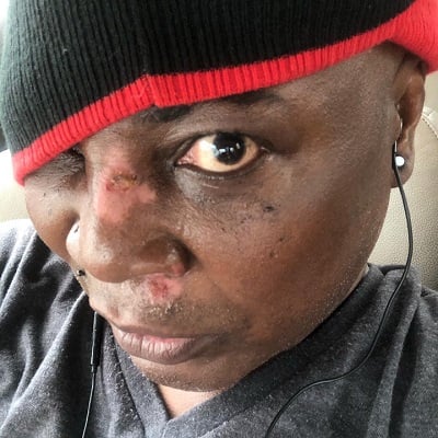 Charly Boy sustains facial injuries in scooter accident