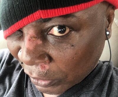 I’m fine, Charly Boy says after surviving scooter accident