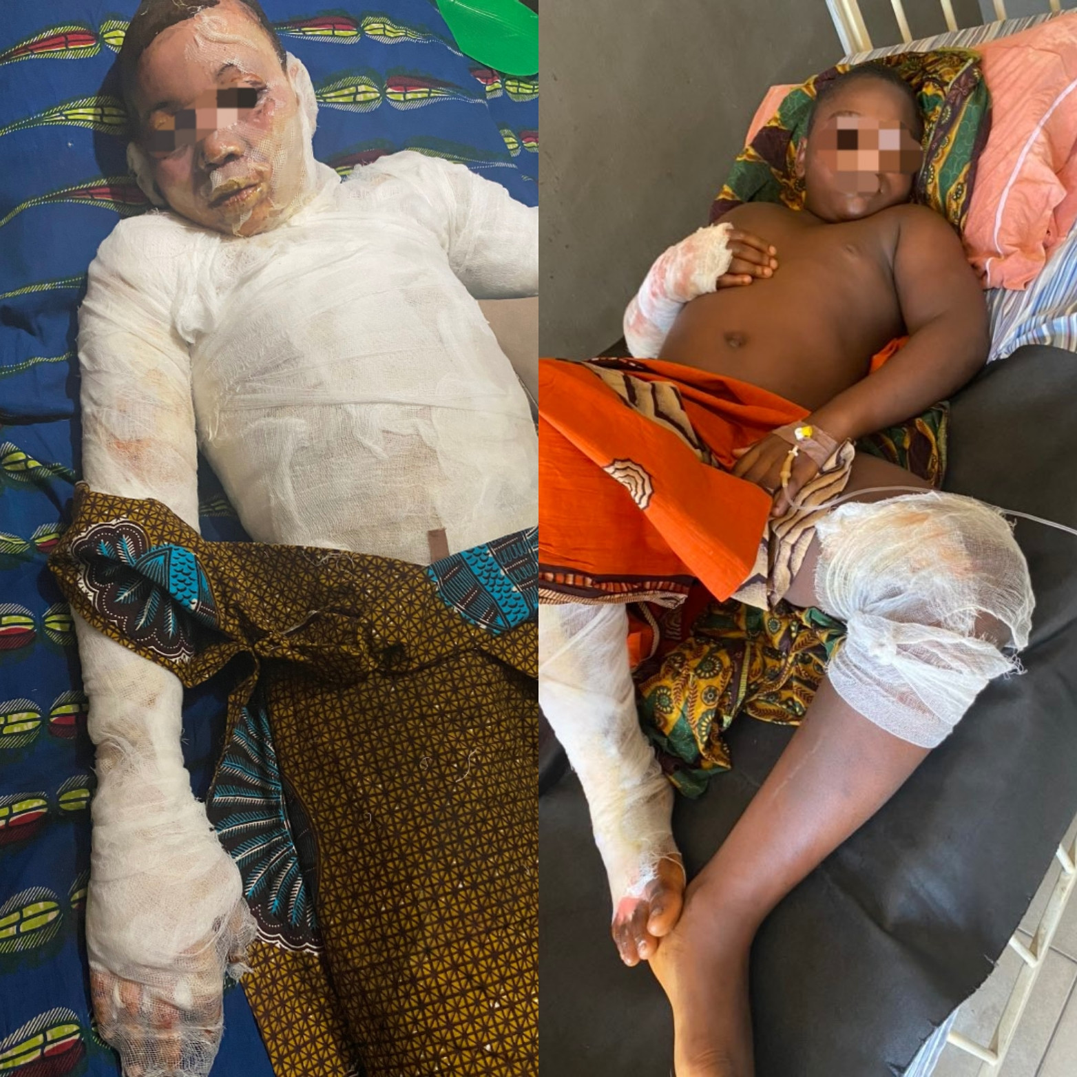 Two brothers suffer severe burns as fire engulfs their family home (graphic photos)