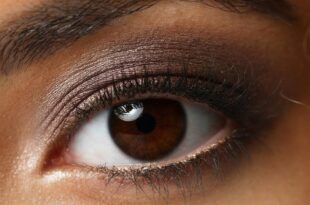 Here are the possible causes of eye colour