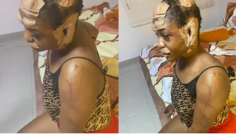 Lady sustains serious injuries after she was allegedly attacked by suspected kidnappers in Lagos (video)