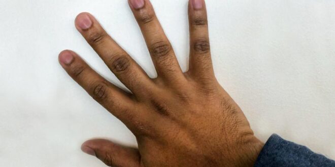 5 ways to get rid of dark knuckles