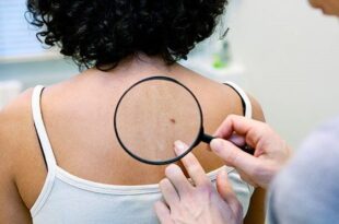 6 Skin Conditions That Are Signs Of Serious Health Issues
