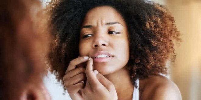 Skincare secrets: 5 reasons why pimples might ruin your big day