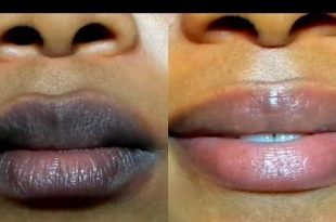 Natural Remedies: 5 natural ways to get pink lips google.com