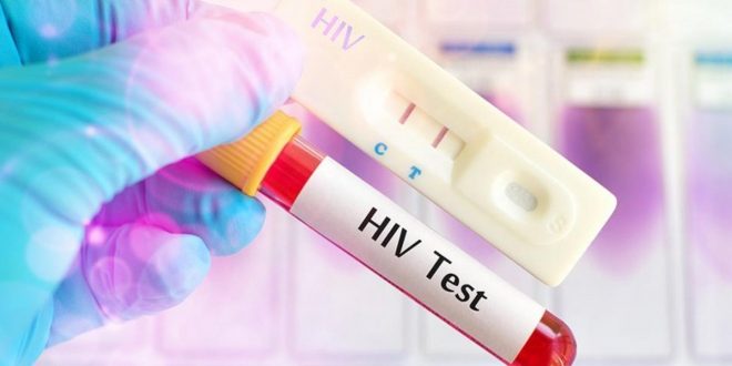 Rare case of a woman cured HIV without stem cell treatment
