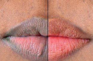 5 kitchen ingredients that you can use for pink lips