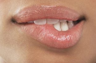 Harmattan: 5 ways to prevent dry, chapped lips