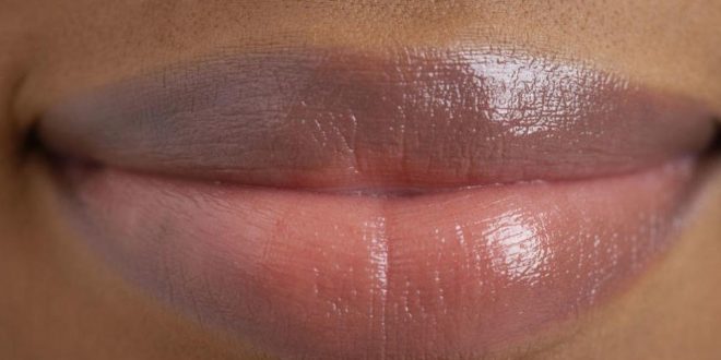 5 habits that are making your lips dark