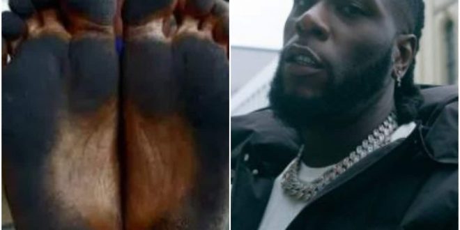 'Dark Clouds Over My City' - Burna Boy Cries Out Over Soot Pollution In Port Harcourt