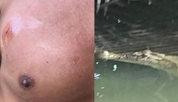 Brave man narrates how he survived crocodile attack after the reptile bit into his skin