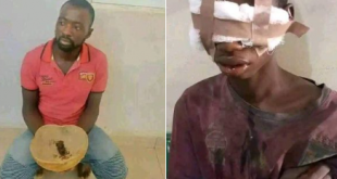 Man and his accomplices arrested for plucking out eyes of 16-year-old boy in Bauchi