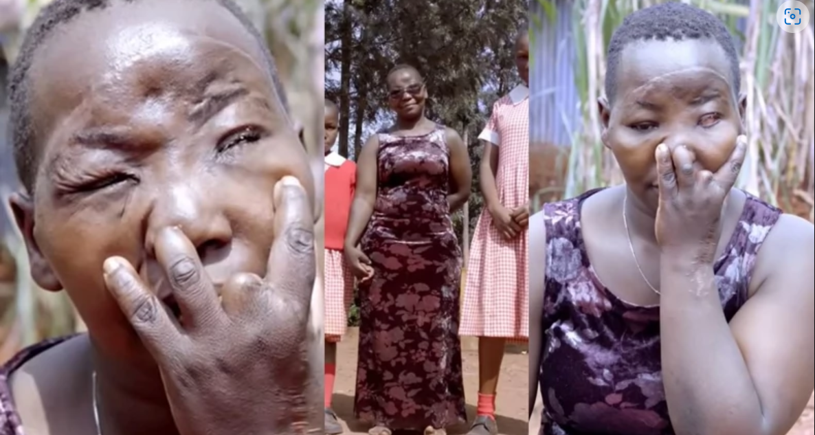 My jealous husband removed my eye and cut off my fingers ? Woman narrates (video)