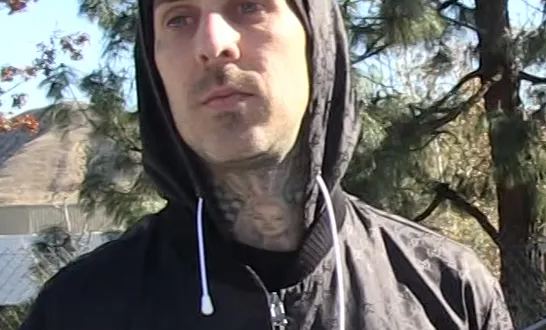 Travis Barker is in hospital for pancreatitis after colonoscopy