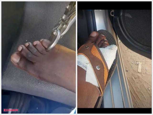 Zimbabweans citizens allegedly cutting and?selling off their toes amidst rising cost of living in the country (photos/video)