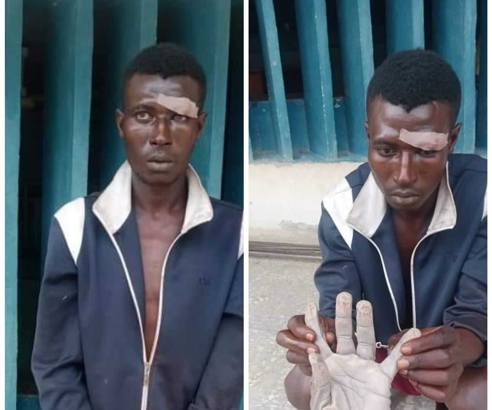 21-year-old man chops off opponent