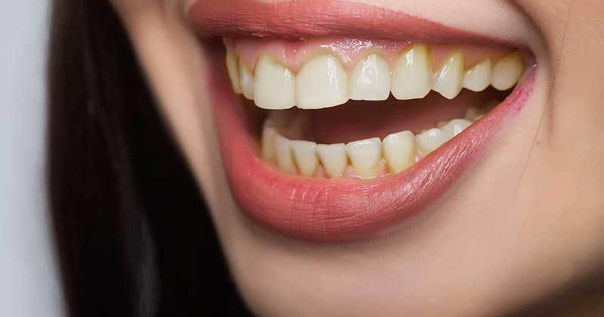 5 reasons your teeth are turning yellow
