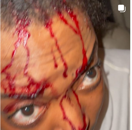 Actress Helen Duru left with a fractured skull and covered in blood after allegedly being attacked by