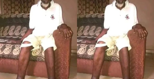Nollywood Actor Cries Out For Help As He Battles Serious Sickness That Makes It Hard To Defecate