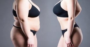 Why you shouldn’t believe before and after weight loss pictures online