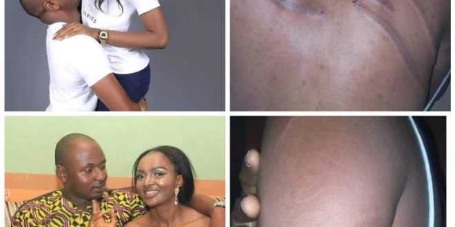 "I was beaten like a common criminal" - Nigerian woman accuses her estranged husband of threatening to kill her after she left him due to alleged domestic violence