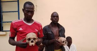 Two men arrested with human skull in Adamawa (photos)