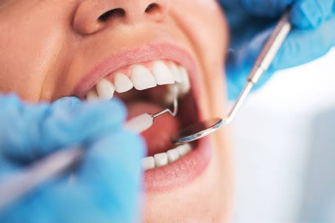 3.5 billion people suffer from oral diseases – WHO