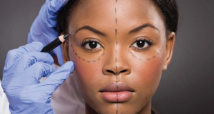 5 important things you need to know before undergoing plastic surgery