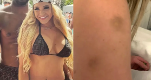 New photos show OnlyFans star Courtney Clenney covered in bruises after stabbing Nigerian boyfriend to death