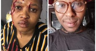 "Welcome to South Africa where you can do this to a woman and get a R500 bail" - Lady reacts as court grants bail to her baby daddy who allegedly attacked her with bottle