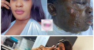Cameroonian lady allegedly pours hot oil on her colleague