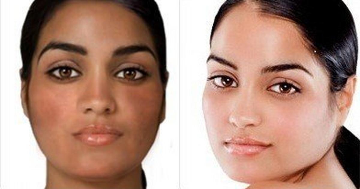 Here are all the ways bleaching destroys your skin and health