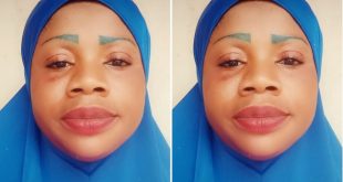 Nurse arrested in Ogun for allegedly injecting 22-year-old graduate in the nerve, causing permanent disability to his leg
