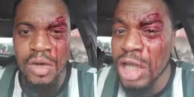 Woman Who Ordered Attack Of Actor Akeem Adeyemi Gets Exposed