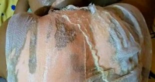 Court remands woman for pouring hot water on her co-wife in Kwara