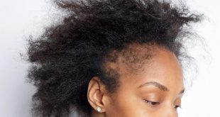 5 things that damage the hair and hairline of African women