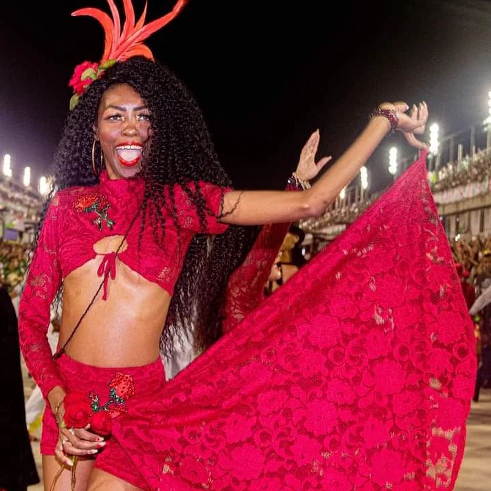 Samba dancer goes in for surgery on her uterus and wakes up with her arm amputated (photos)