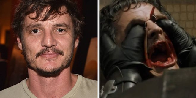 Actor Pedro Pascal left with eye infection from fans recreating his ‘Game of Thrones’ death scene