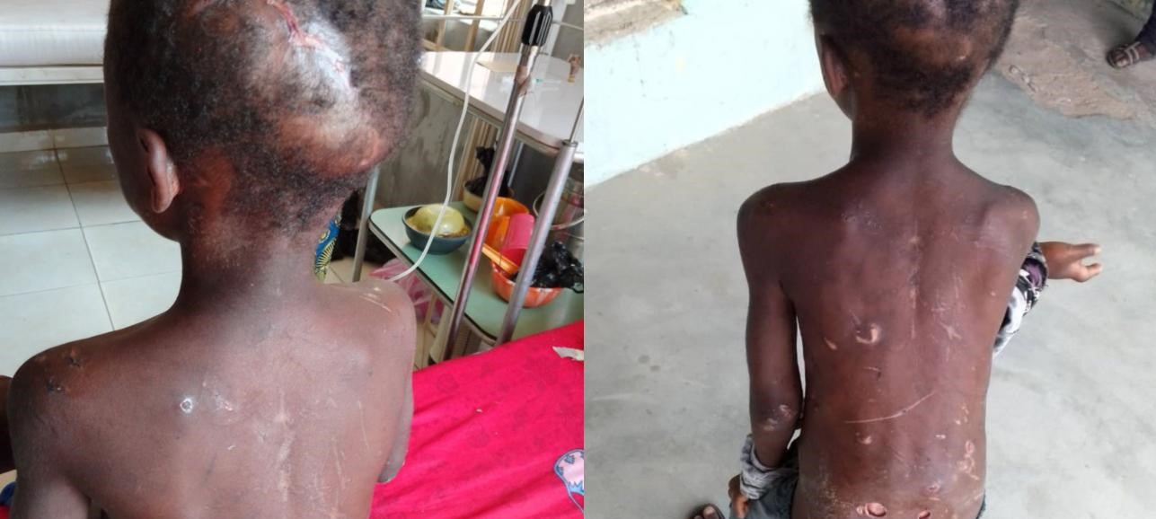 Woman brutalizes 7-year-old domestic help for failing to do chores in Adamawa